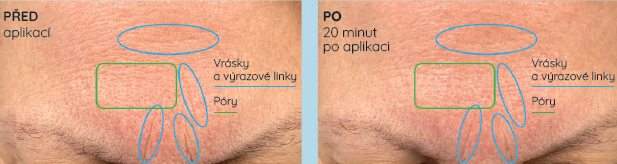 pred-po-aplikace